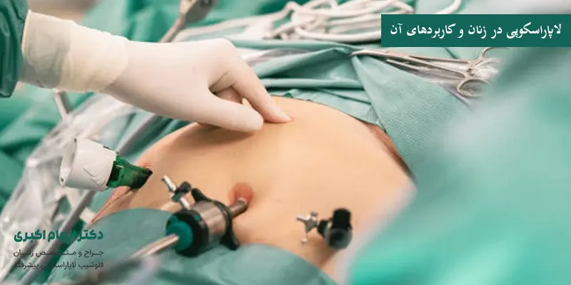 لاپاراسکوپی در زنان و کاربردهای آن