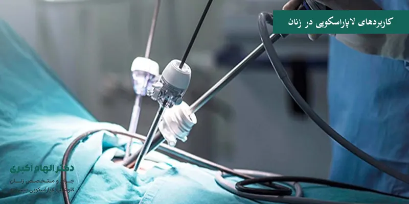 کاربردهای لاپاراسکوپی در زنان