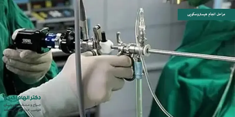 مراحل انجام هیستروسکوپی