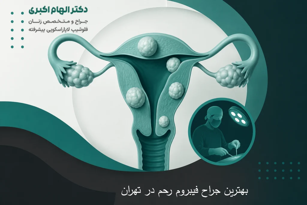 بهترین جراح فیبروم رحم در تهران