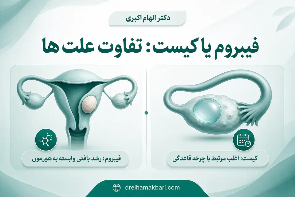 تفاوت فیبروم رحم و کیست + علت، علائم و درمان