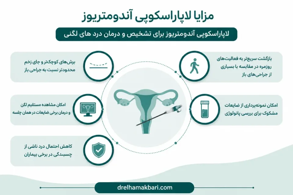 نمای توضیحی درباره مزایا لاپاراسکوپی آندومتریوز