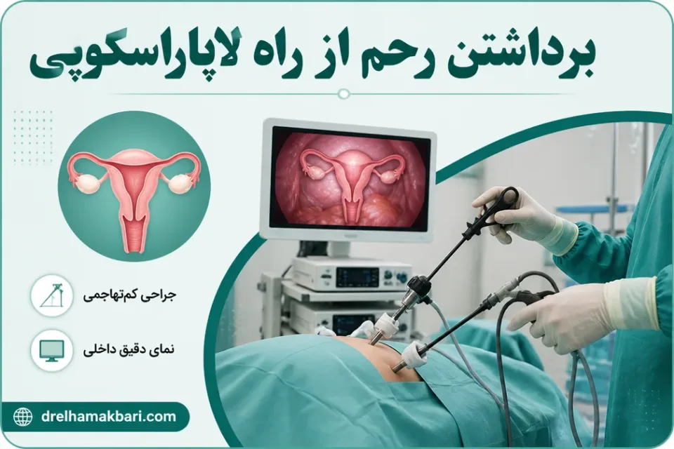 برداشتن رحم از راه لاپاراسکوپی — نمای آموزشی از کاربرد لاپاراسکوپی در بررسی و درمان بیماریهای رحم و لگن