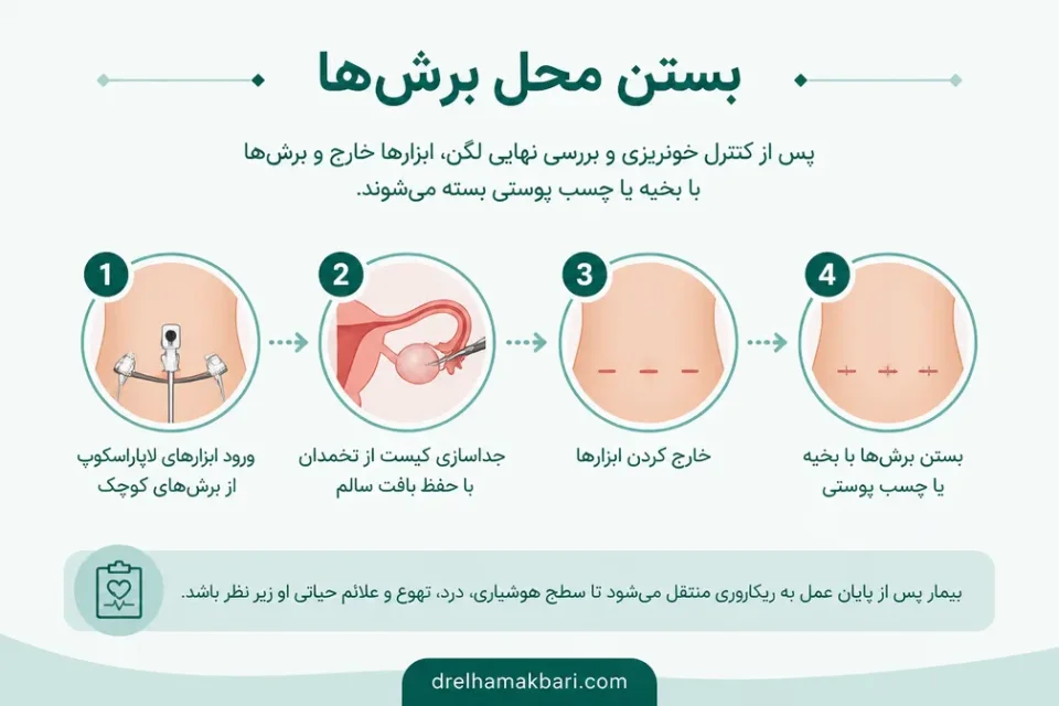 نمای توضیحی درباره بستن محل برشها