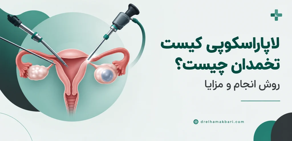لاپاراسکوپی کیست تخمدان چیست