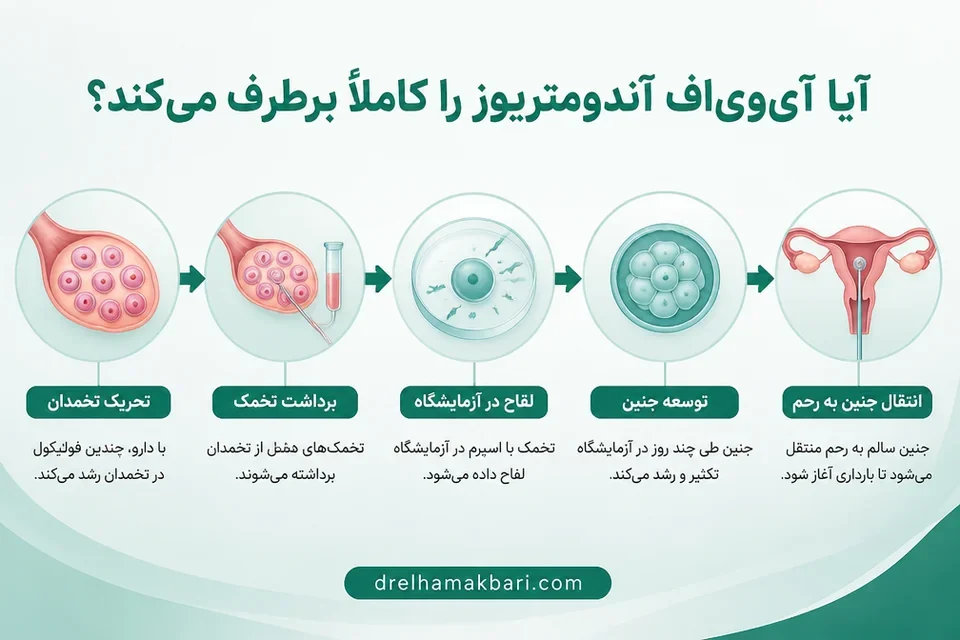 مراحل آی وی اف از تخمک تا انتقال جنین