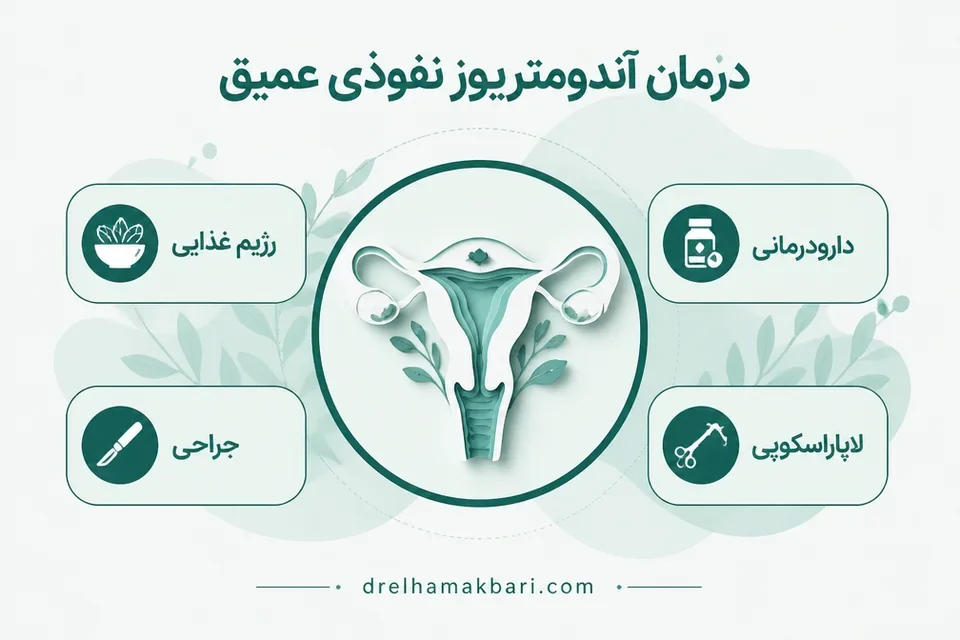 درمان آندومتریوز نفوذی عمیق