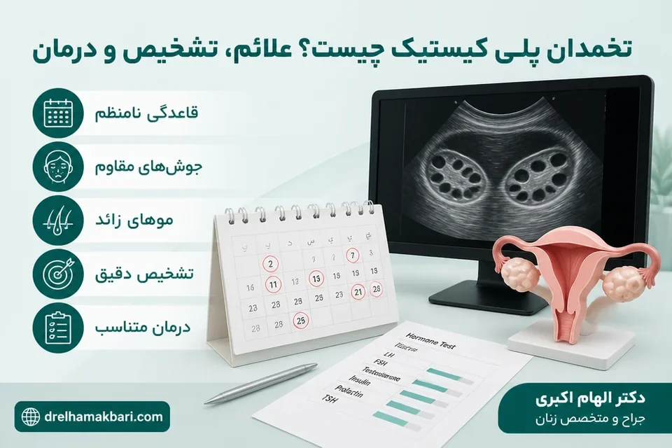 تخمدان پلی کیستیک چیست؟ علائم، تشخیص و درمان